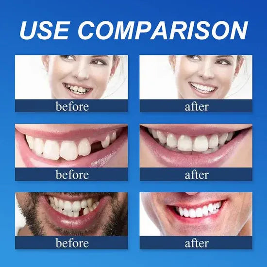 🌎Ends Today: 70% OFF! ⏰LUMIVO® Medical Full Denture with Strong Suctiond🦷Obtain American Dental Association (ADA) Certification